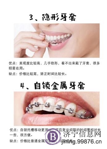济宁矫正牙齿多少钱|济宁哪里牙齿矫正好